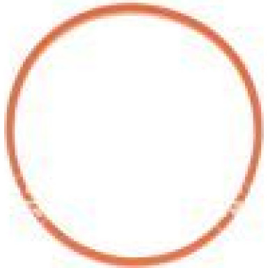 NRF | Drosselklappenstutzen | 408022 NRF | Drosselklappenstutzen | 408022